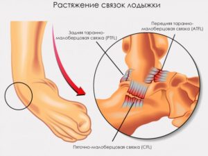 Ортез на голеностоп AM-SX-08